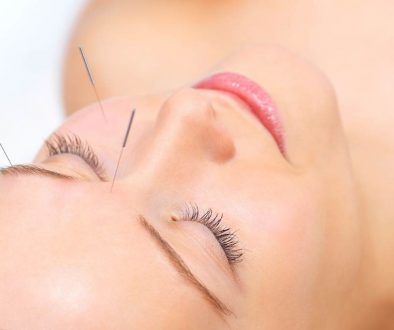 Acupuntura em Joinville Corpore miano acupuntura para estética dor facial saúde